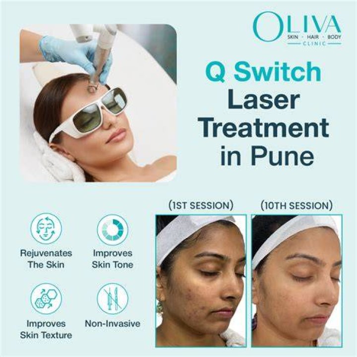 India Royale before surgery Looks Like Q How India Royale before surgery Looks Like